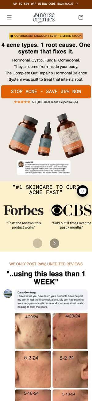 Top of norseorganics.co/pages/acne-types-internal