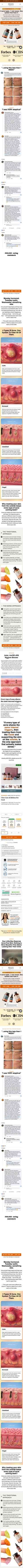 Full page norseorganics.co/pages/acne-types-internal