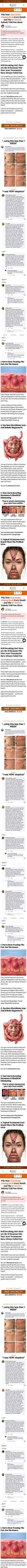 Full page norseorganics.co/pages/10-reasons-why-acne-comes-back